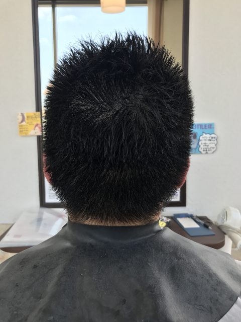 写真:Before