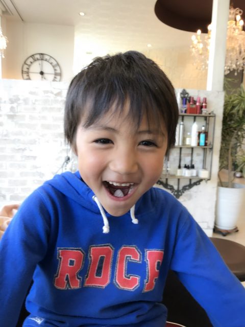 写真:After