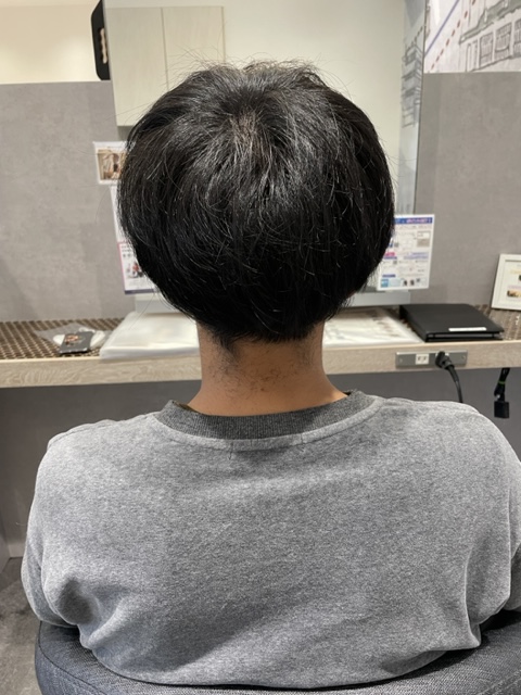写真:Before