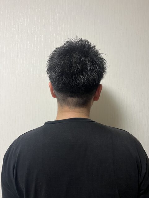 写真:After