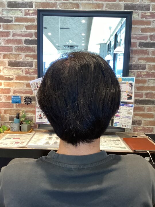 写真:Before