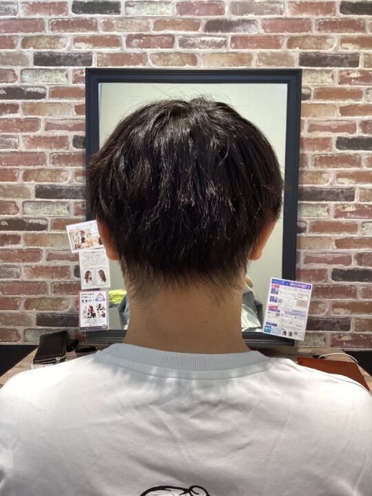 写真:Before