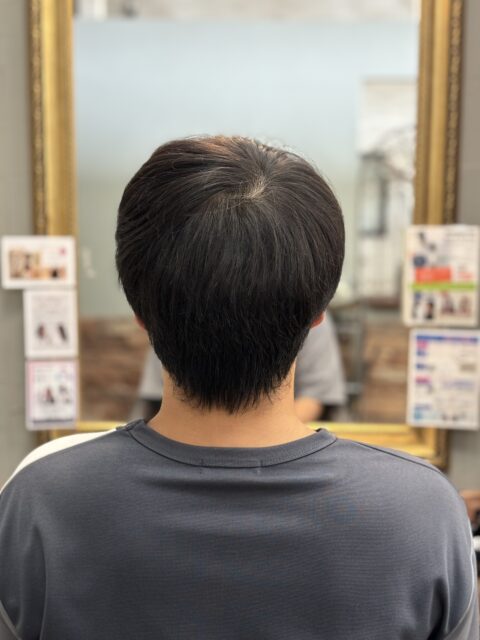 写真:Before