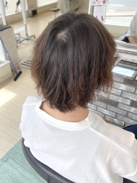 写真:Before