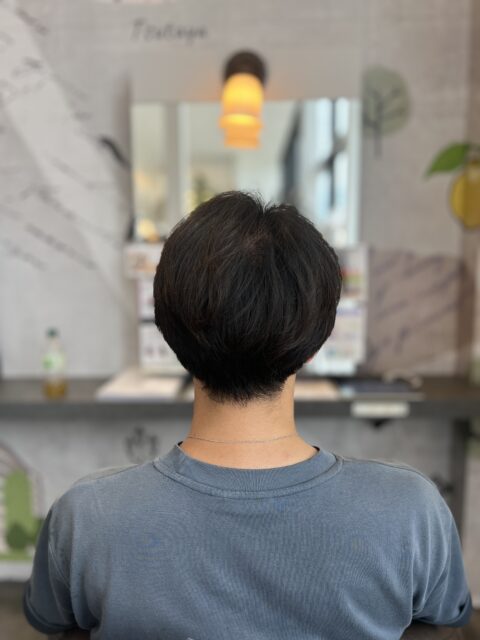 写真:Before