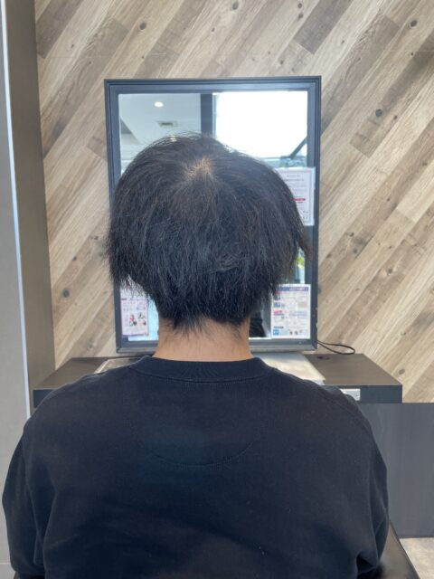 写真:Before