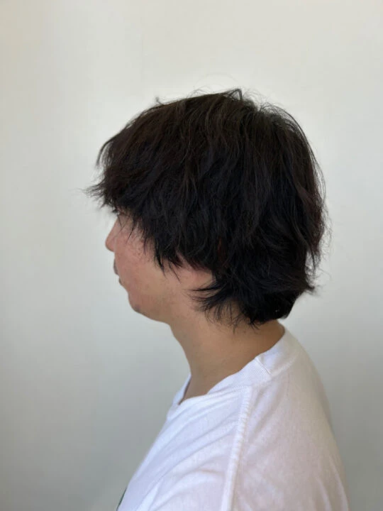 写真:Before
