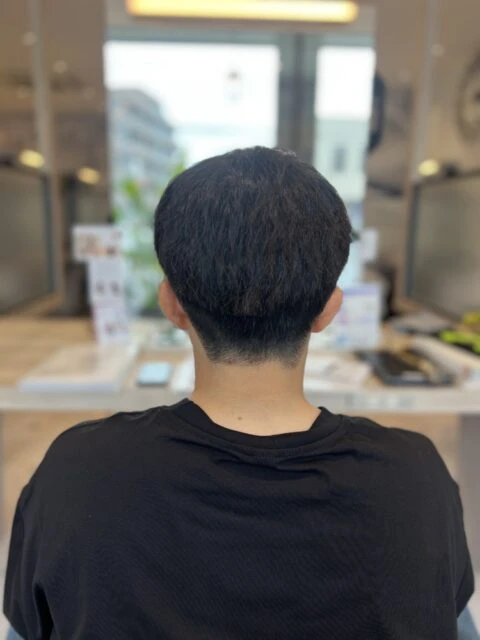 写真：Before