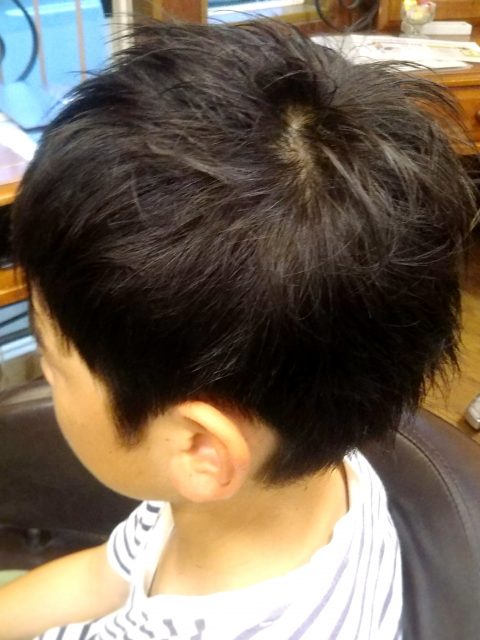 写真：After