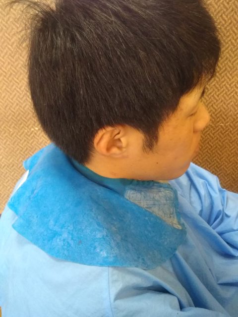 写真：Before