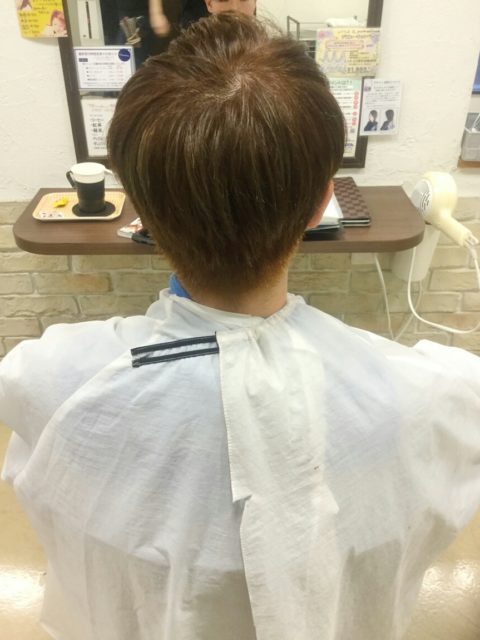 写真:After