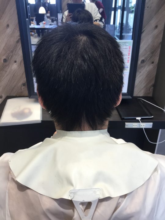 写真:Before