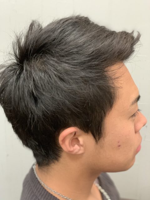 写真:Before