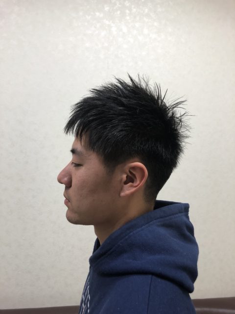 写真:After