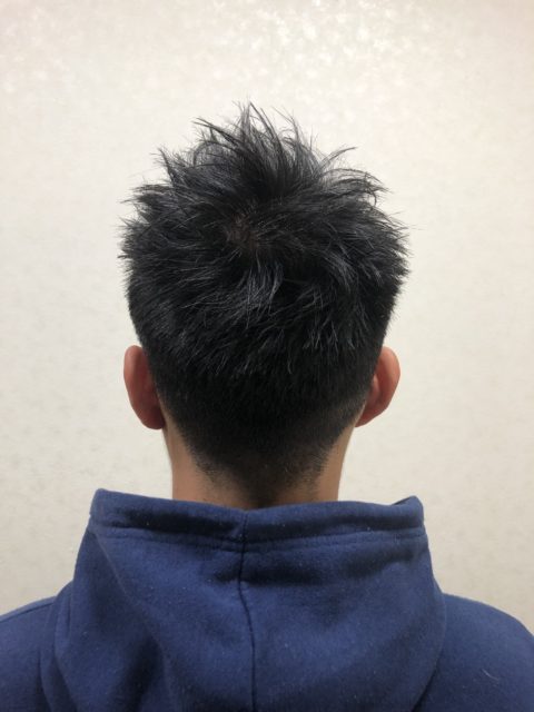写真:After