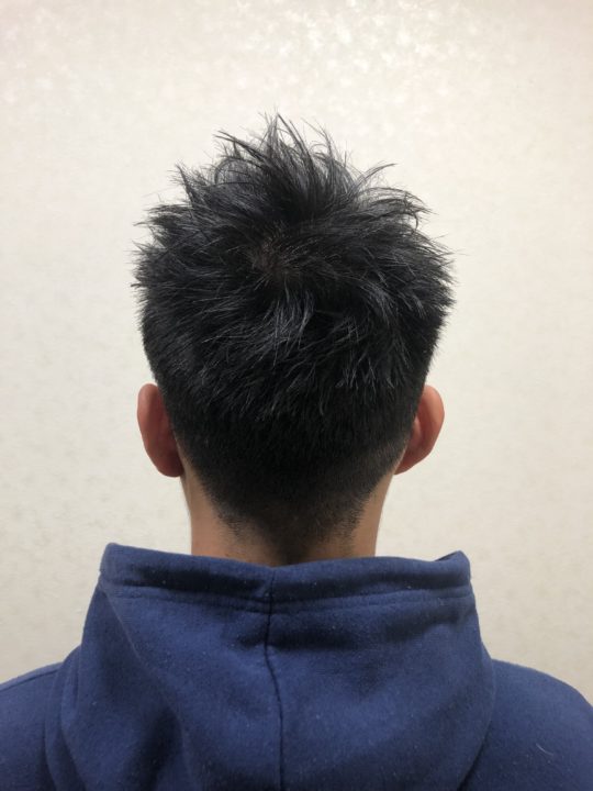 写真:After