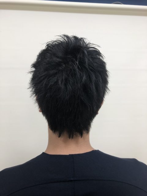 写真:After