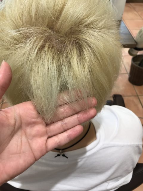 写真：After