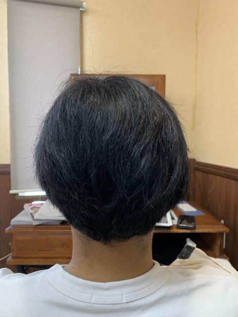 写真：Before