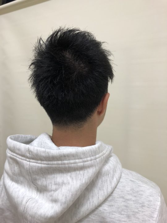 写真:After