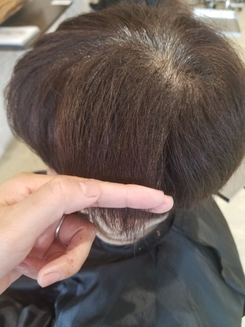 写真：Before