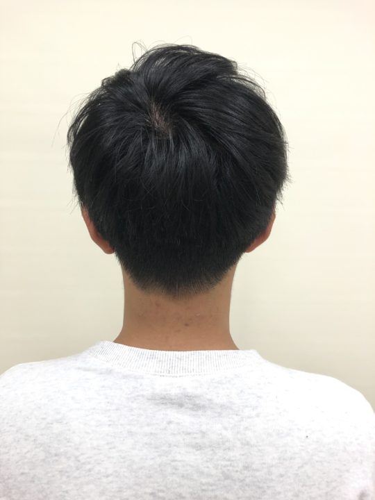写真:After