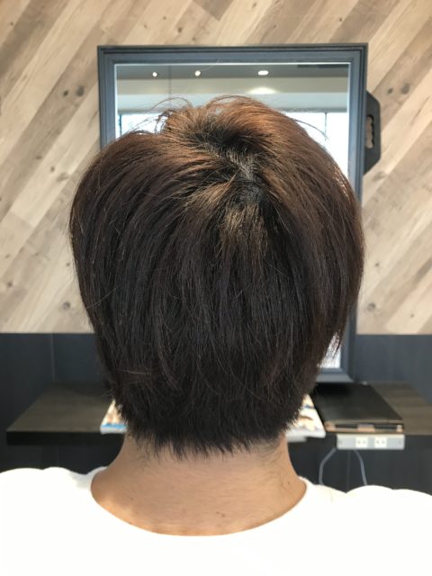 写真:Before