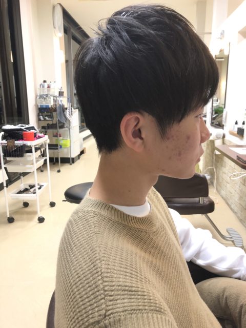 写真:Before