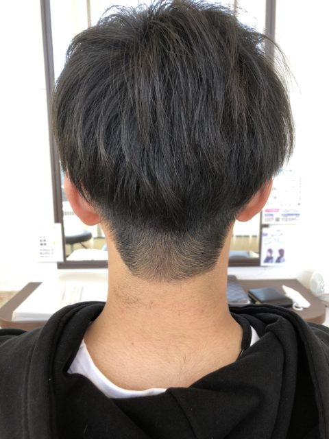 写真:Before