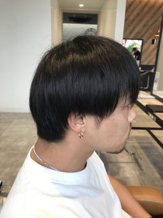 写真:Before