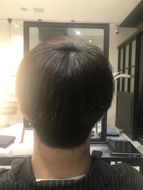写真:Before