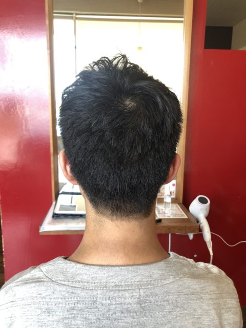 写真：After