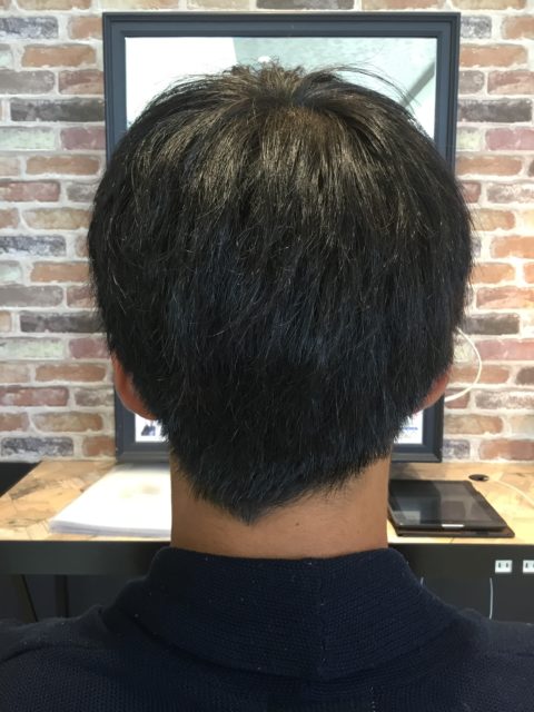 写真：Before