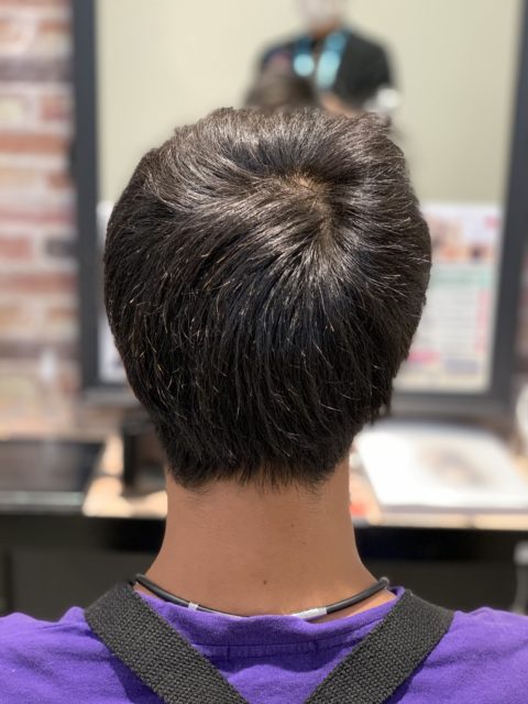 写真:Before