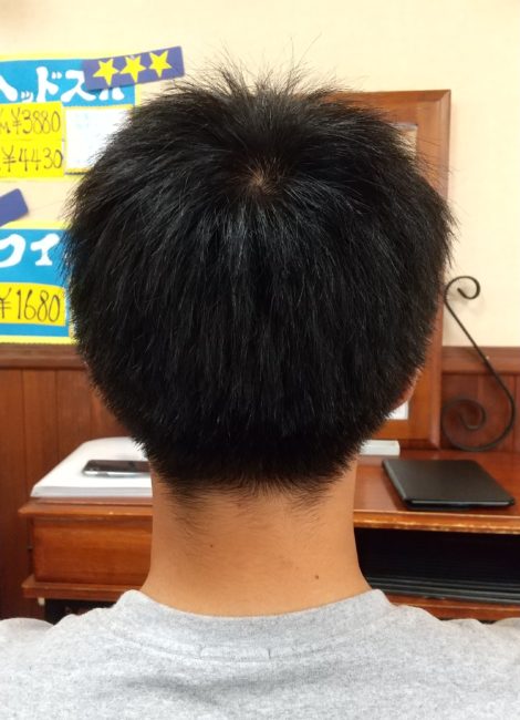 写真：Before