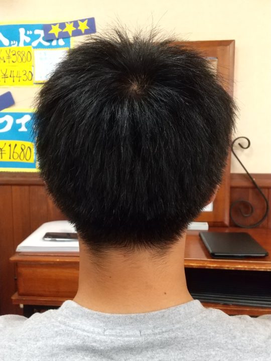 写真：Before