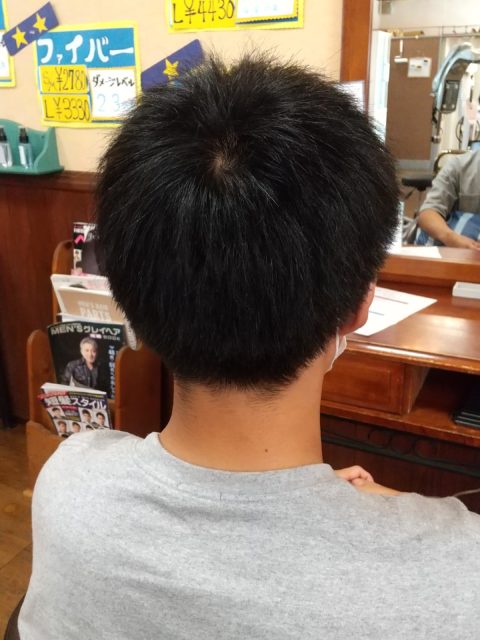 写真：Before