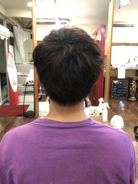 写真：Before