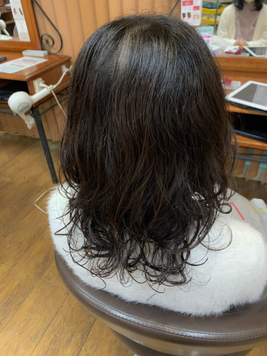 写真：After