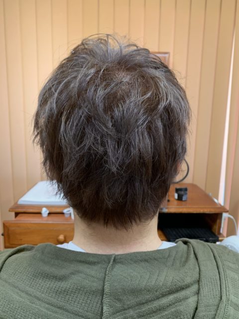 写真：After