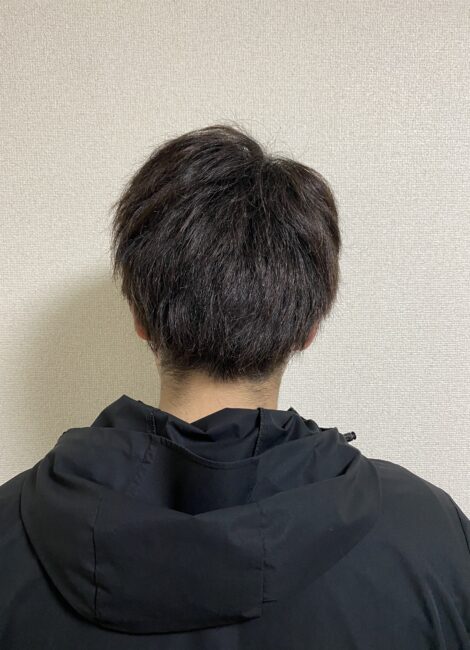 写真：Before