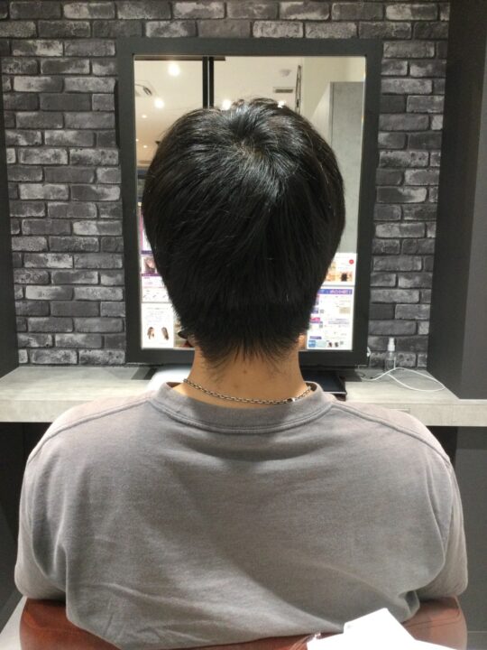 写真：Before