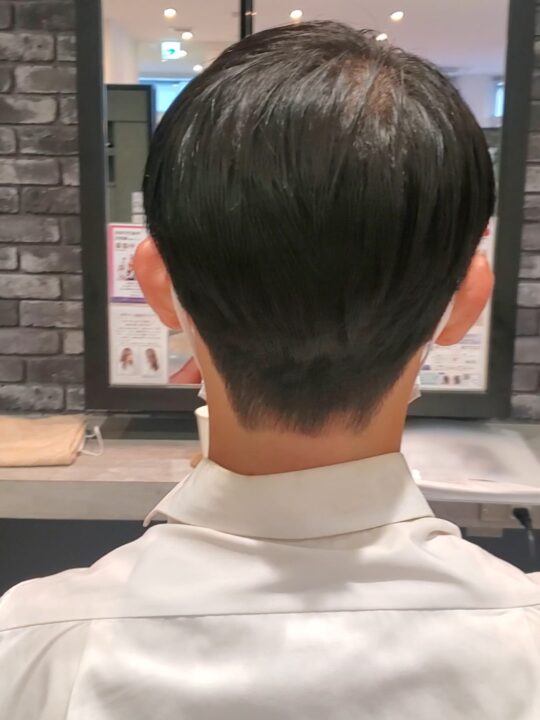 写真:After