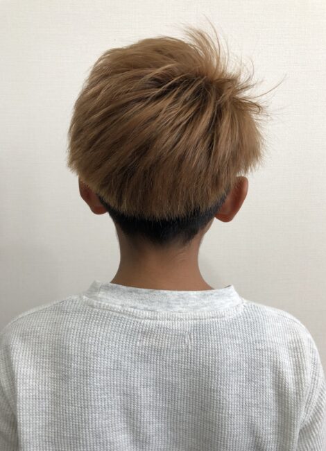 写真：After