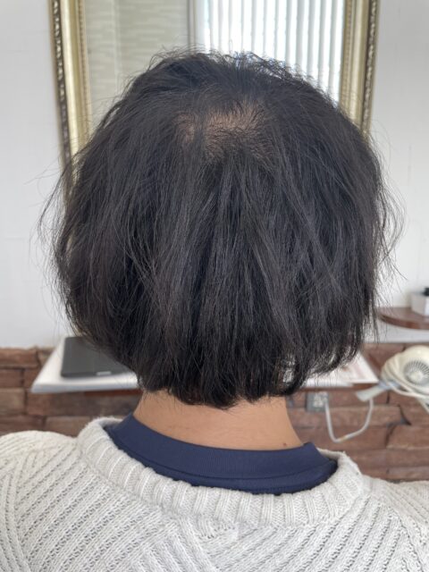 写真:After