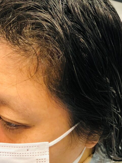 写真:Before