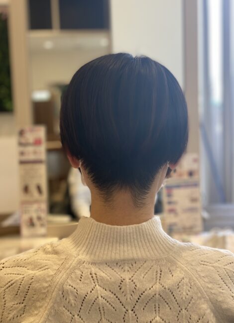 写真：Before