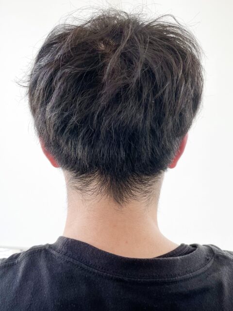 写真:Before
