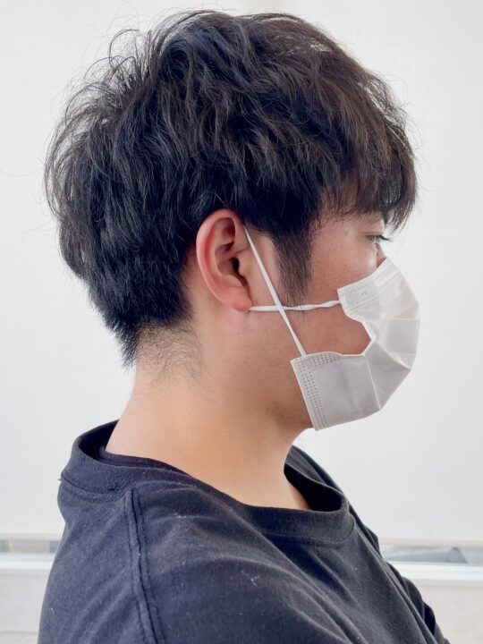 写真:Before