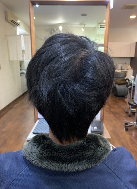 写真：Before